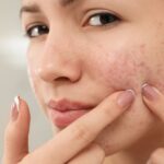Best aesthetic clinic in dubai